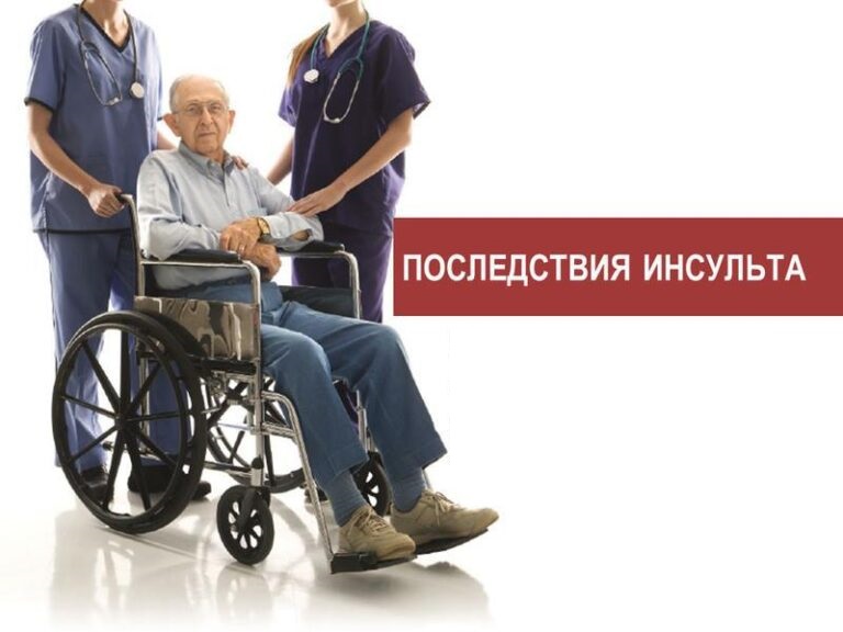 инсульт